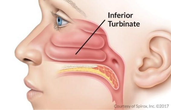 Paediatric nasal turbinate cautery Brisbane, diagram showing the inferior turbinate inside the nose